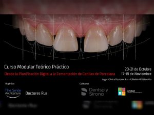 Curso-Estética-Dental-Desde-la-Planificación-Digital-a-la-Cementación