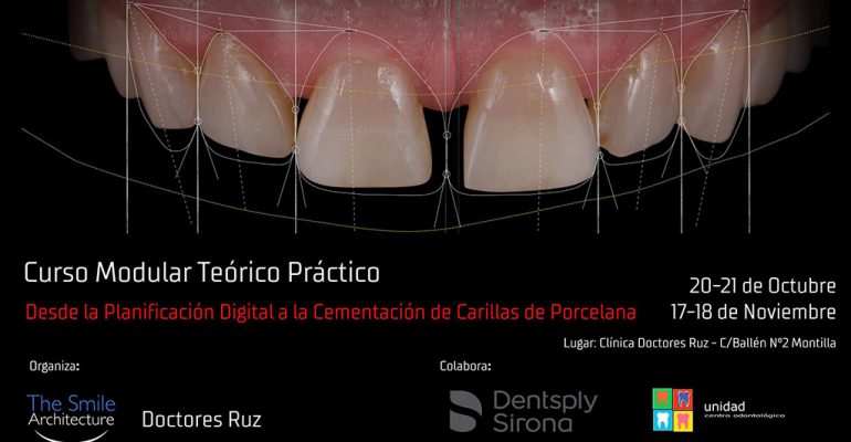 Curso-Estética-Dental-Desde-la-Planificación-Digital-a-la-Cementación-de-Carillas-de-Porcelana-–-Montilla-2 Curso Estética Dental Desde la Planificación Digital a la Cementación de Carillas de Porcelana – Montilla
