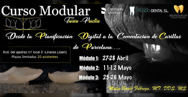 Curso Modular Desde la Planificación Digital a la Cementación de Carillas de Porcelana – Jaén
