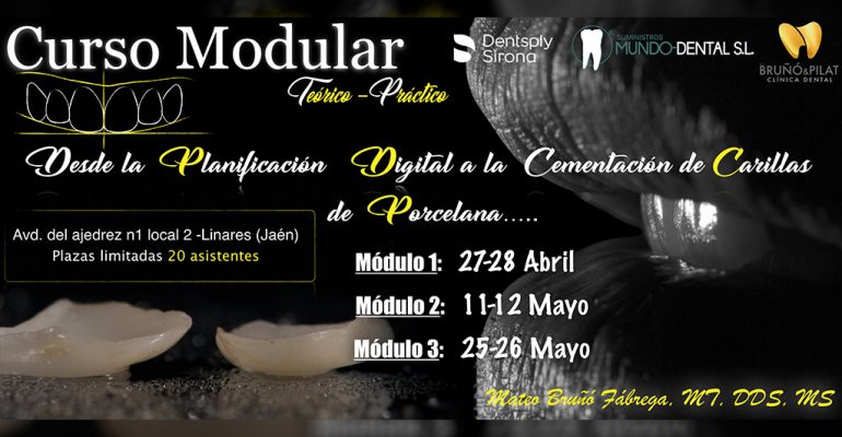 curso-carilas Curso Modular Desde la Planificación Digital a la Cementación de Carillas de Porcelana – Jaén