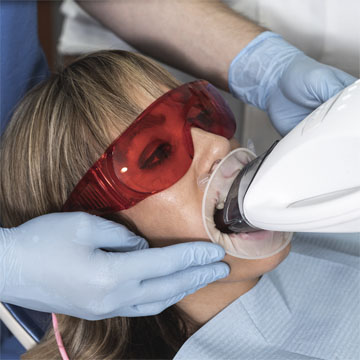Estética dental tratamientos