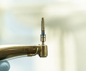 Implantología dental clínica dental Castellón