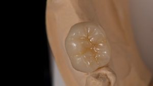 Periodoncia dental clínica Castellón