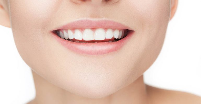 Dentista Castellón alargamiento de corona Prepara el tratamiento de alargamiento de coronas en tu dentista Castellón de confianza
