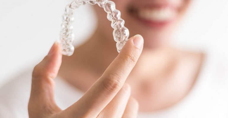 Ortodoncia invisible Invisalign Castellón Ortodoncia invisalign ¿Sí o no?