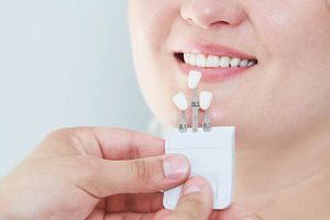 Reconstrucción dental Castellón Reconstrucción dental Castellón