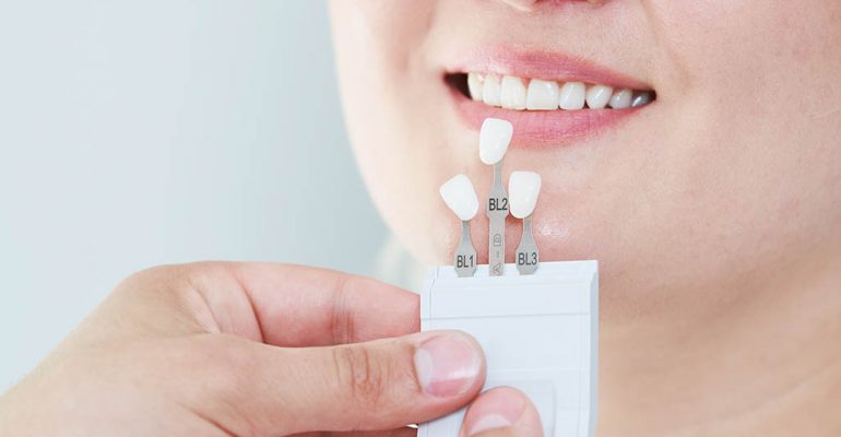 Reconstrucción dental Castellón ¿Qué es y cómo se realiza la reconstrucción dental? En Bruñó&Pilat, tu dentista Castellón, te contamos como hacerlo