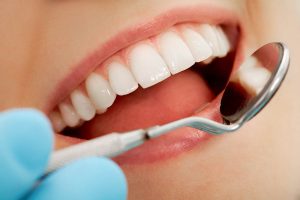 Tratamiento Periodoncia Castellón