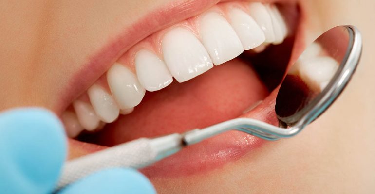 Tratamiento Periodoncia Castellón Tratamientos periodoncia