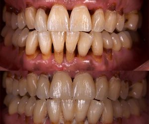 periodoncia