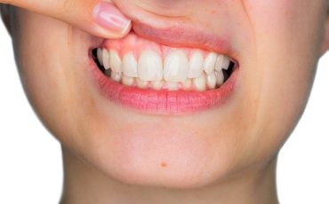 Salud encías Castellón Tips para el cuidado de tus encías