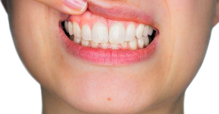 Salud encías Castellón Tips para el cuidado de tus encías