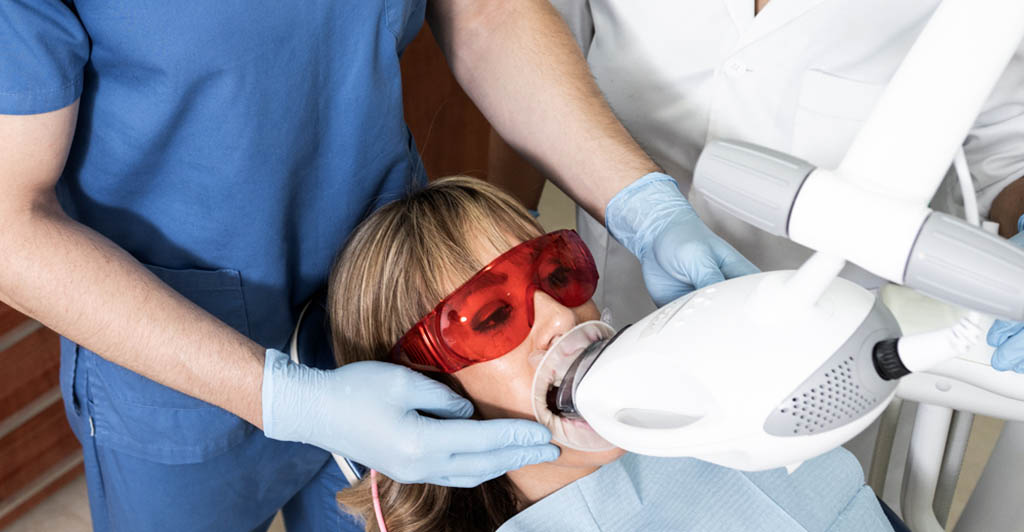 Blanqueamiento dental profesional en Castellón