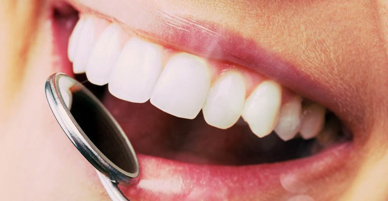 Cinco enfermedades de la boca Estas son las 5 enfermedades bucales más frecuentes