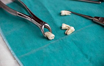 Consejos para seguir tras la extracción de dientes Esto es lo que debes hacer tras una extracción dental