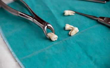 Consejos para seguir tras la extracción de dientes Esto es lo que debes hacer tras una extracción dental