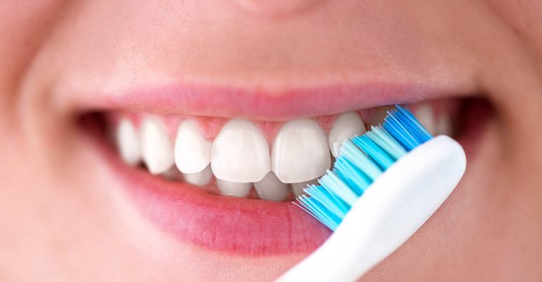 Diferencia entre placa bacteriana y sarro Diferencias entre la placa dental y el sarro